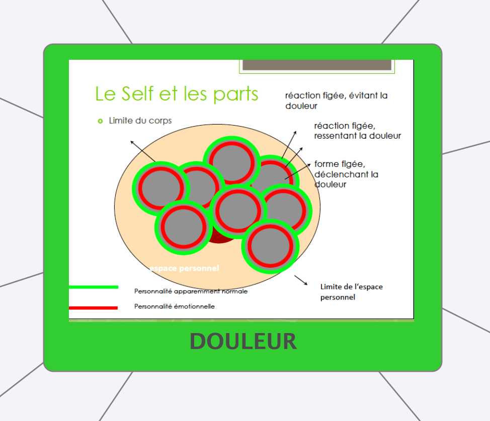 douleur